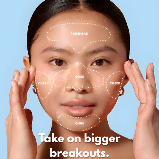 PatchIt™ Face Patch Set